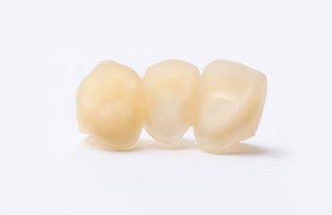 Zortrax Resin Raydent Crown & Bridge 1000ml - 3D Material-Shop